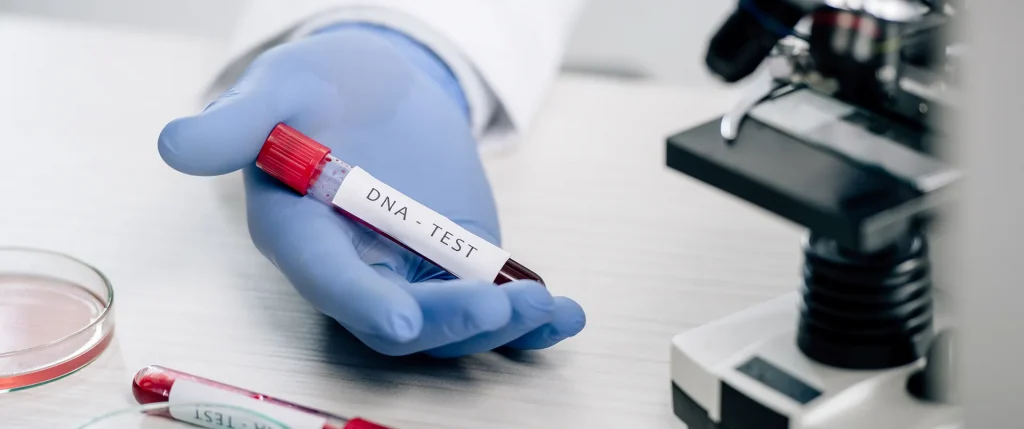 Mano de un profesional médico sosteniendo una tubo con una muestra de sangre para test de ADN